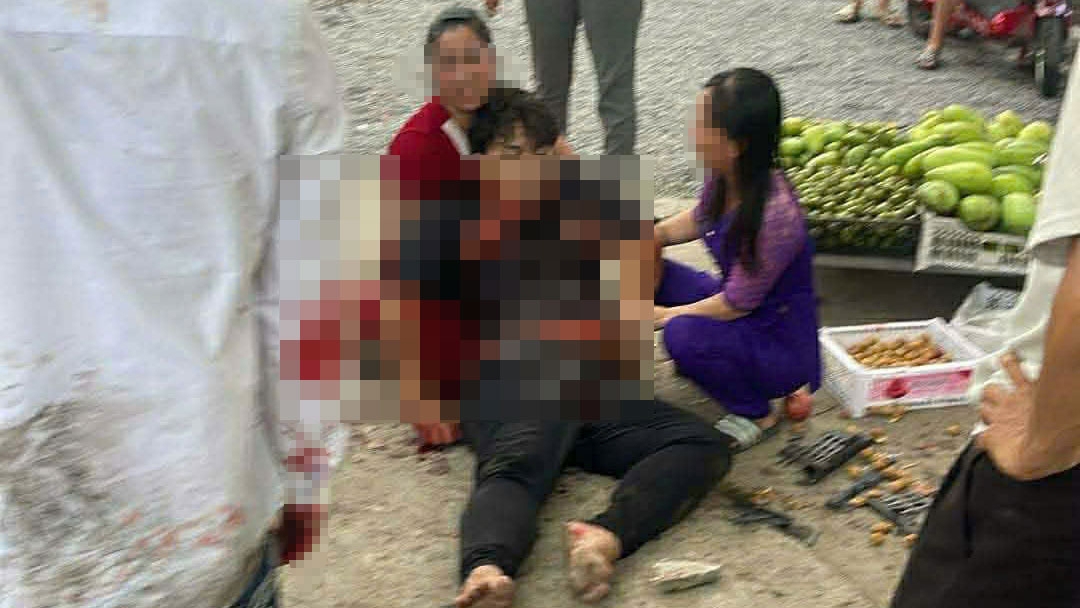 Điều tra vụ ẩu đả khiến một người tử vong trên đường ở TP.HCM